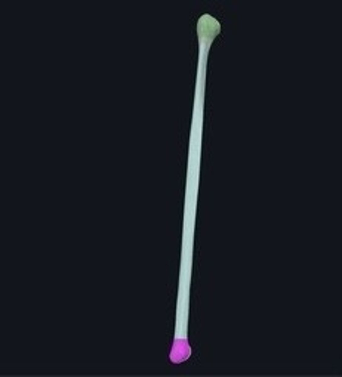 <p>Bony prominence on the fibula's distal end.</p>