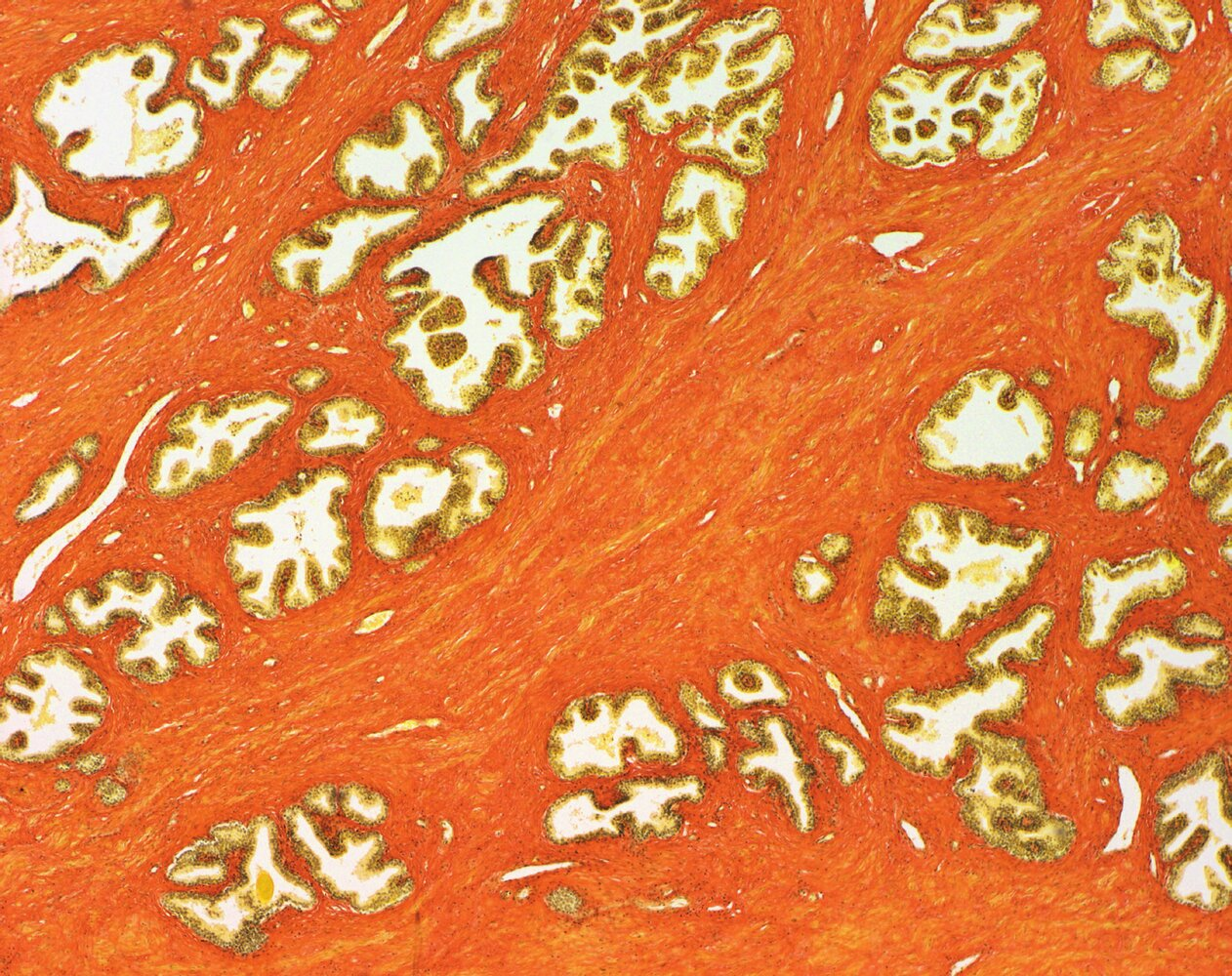<p>9. Which structure is shown in the image (van Gieson stain)?</p><p>A. Endometrium in the secretory phase</p><p>B. Lactating mammary gland (Mamma lactans)</p><p>C. Ovary</p><p>D. Prostate</p><p>E. Rete testis</p>