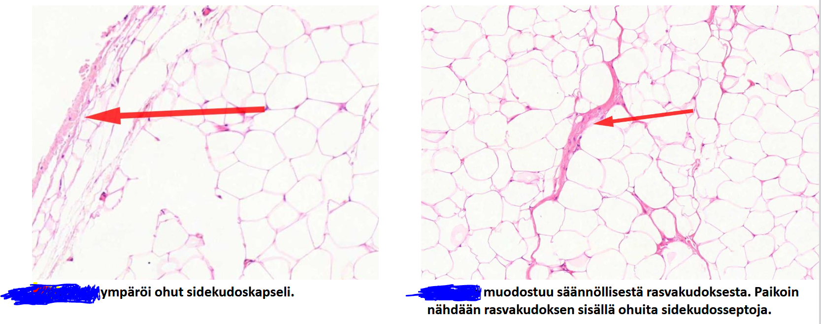 <p>katso kuvia ja tekstejä, mikä tauti on kyseessä?</p>
