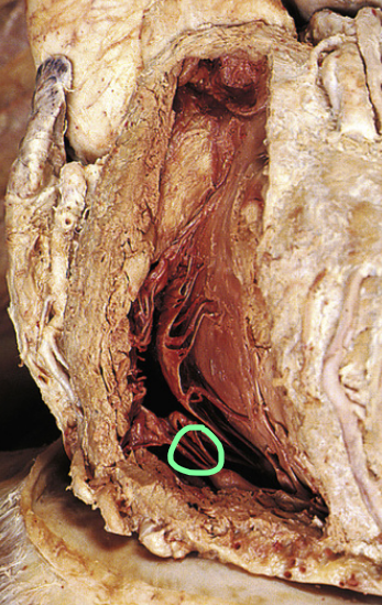 <p>What is circled?</p>
