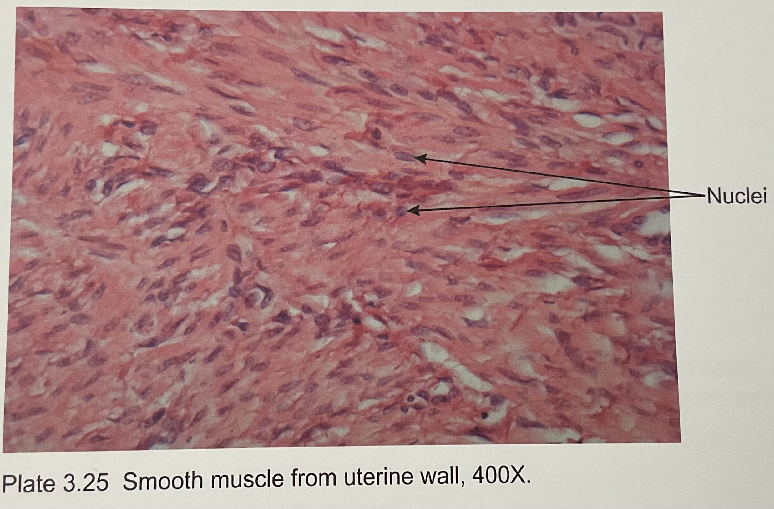 <p>Smooth Tissue </p>