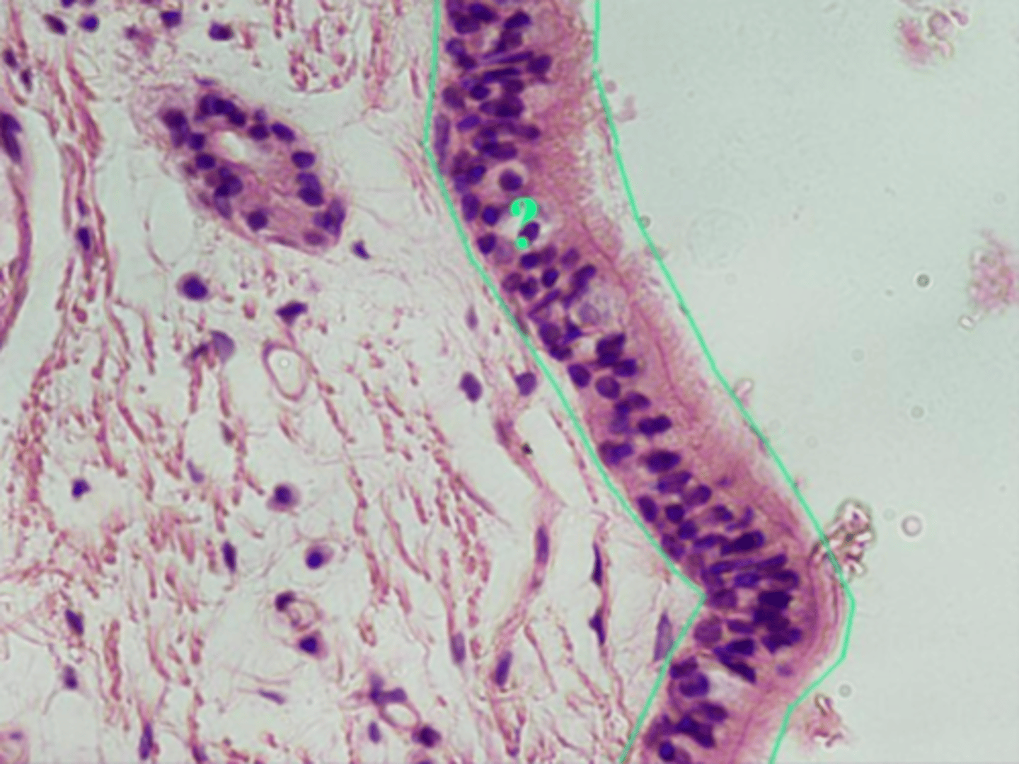 <p>Single layer of tall cells that have differing heights making it appear stratified but with indistinct layers</p><p>Location: (ciliated) trachea, (non-ciliated) male sperm carrying ducts, ducts of large glands</p><p>Function: secretion and propulsion of mucus</p>