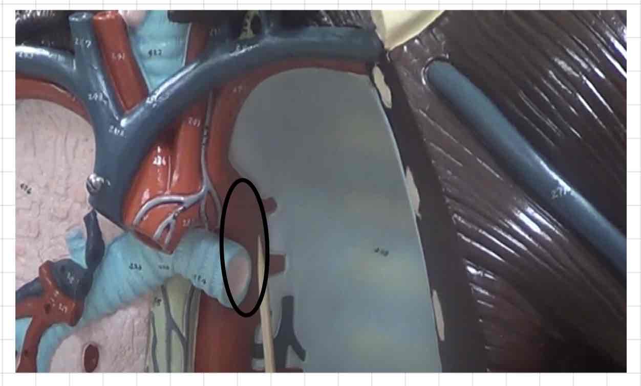 <p>what is this? (torso model)</p>