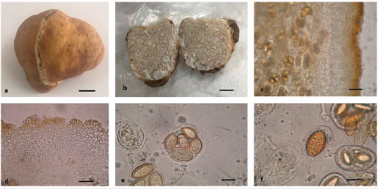 <p>tryffel, mikropreparatet syns ascosporer gömda i hålrum i svampen (ascomycota)</p>
