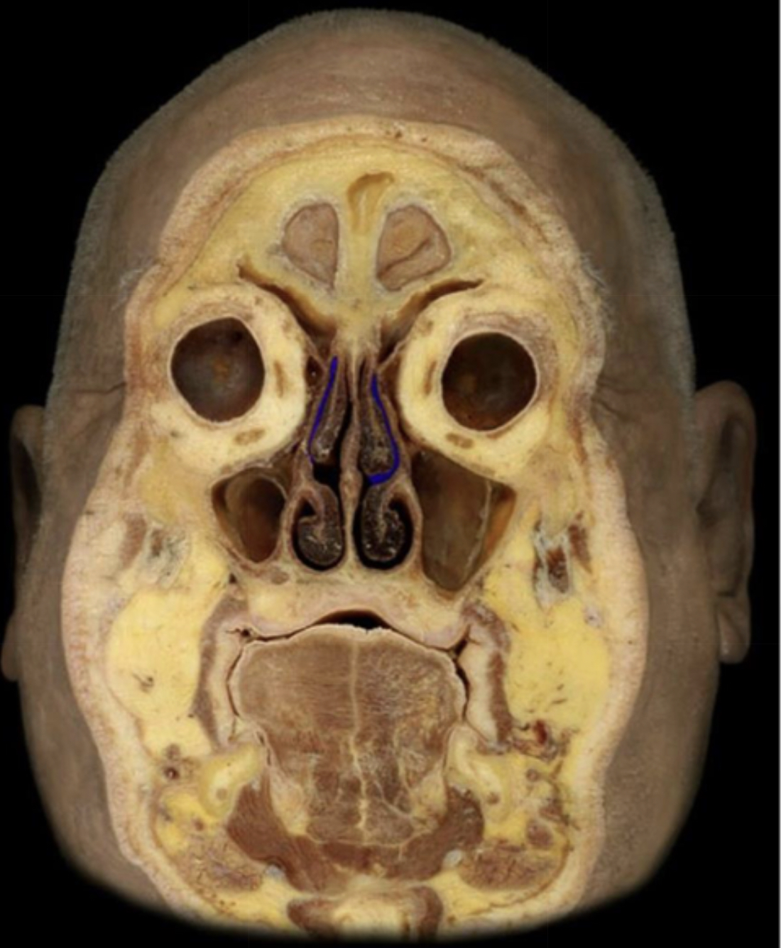 What structure is highlighted in blue?