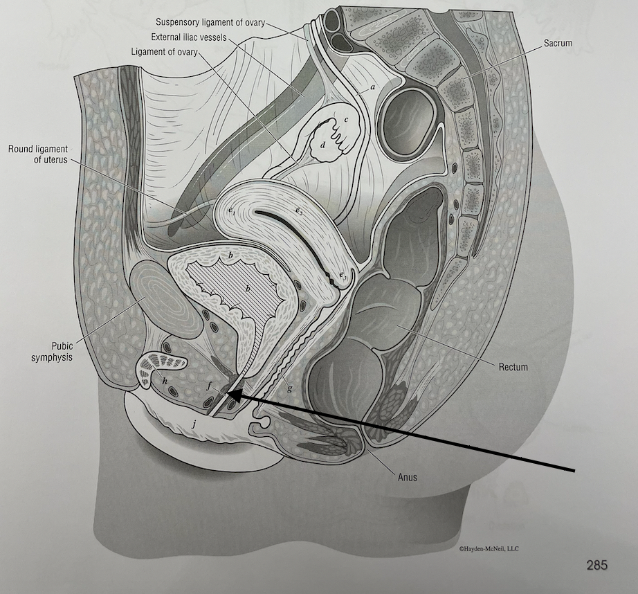 <p>what structure is this</p>