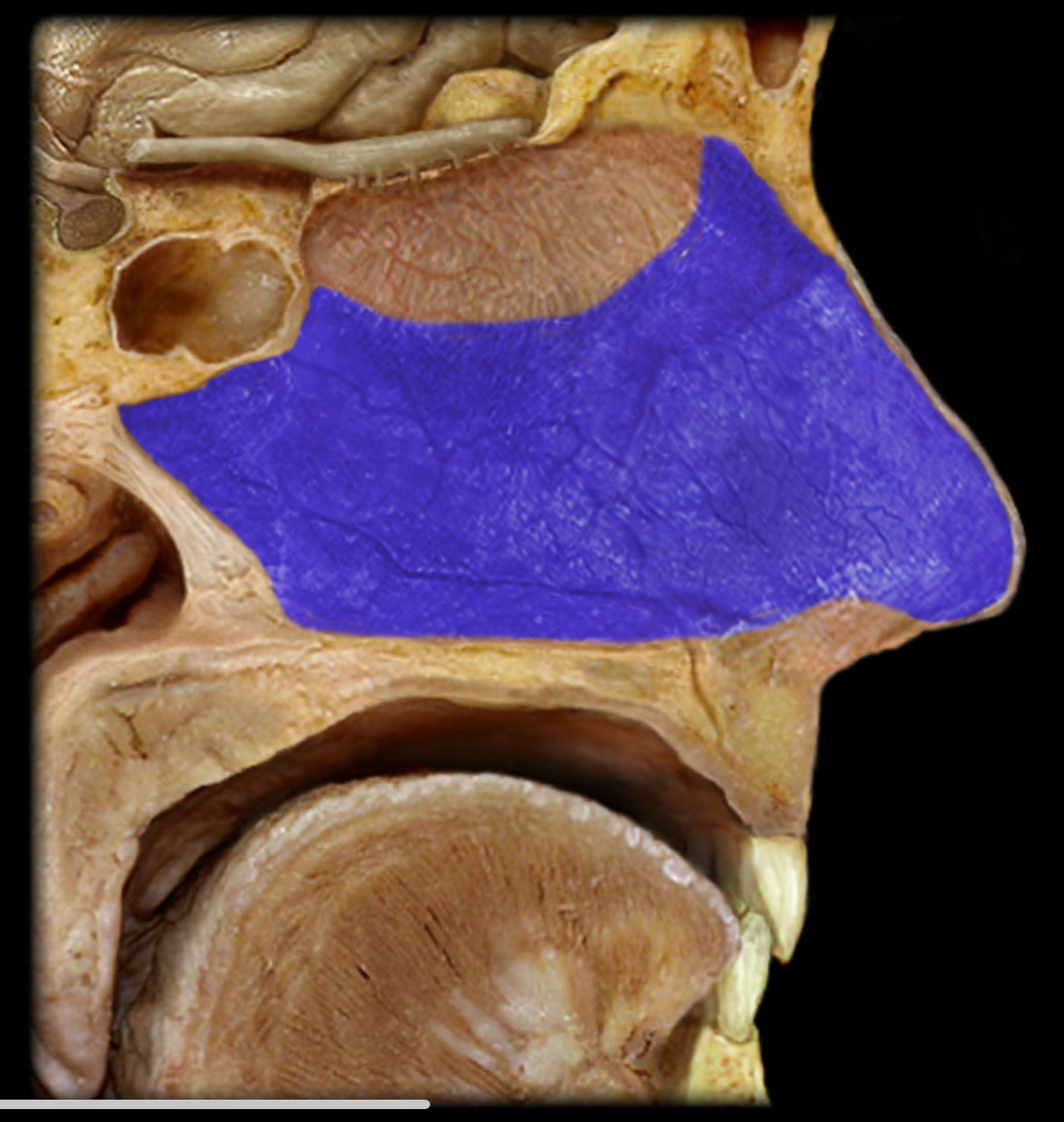 <h4 collapsed="false" seolevelmigrated="true"><strong>Location:</strong></h4><ul><li><p>Nasal cavity (inferior two-thirds)</p></li></ul><h4 collapsed="false" seolevelmigrated="true"><strong>Description:</strong></h4><ul><li><p>Non-olfactory region of nasal mucosa</p></li></ul><h4 collapsed="false" seolevelmigrated="true"><strong>Comment:</strong></h4><ul><li><p>Primary function: warm and humidify inhaled air</p></li></ul>