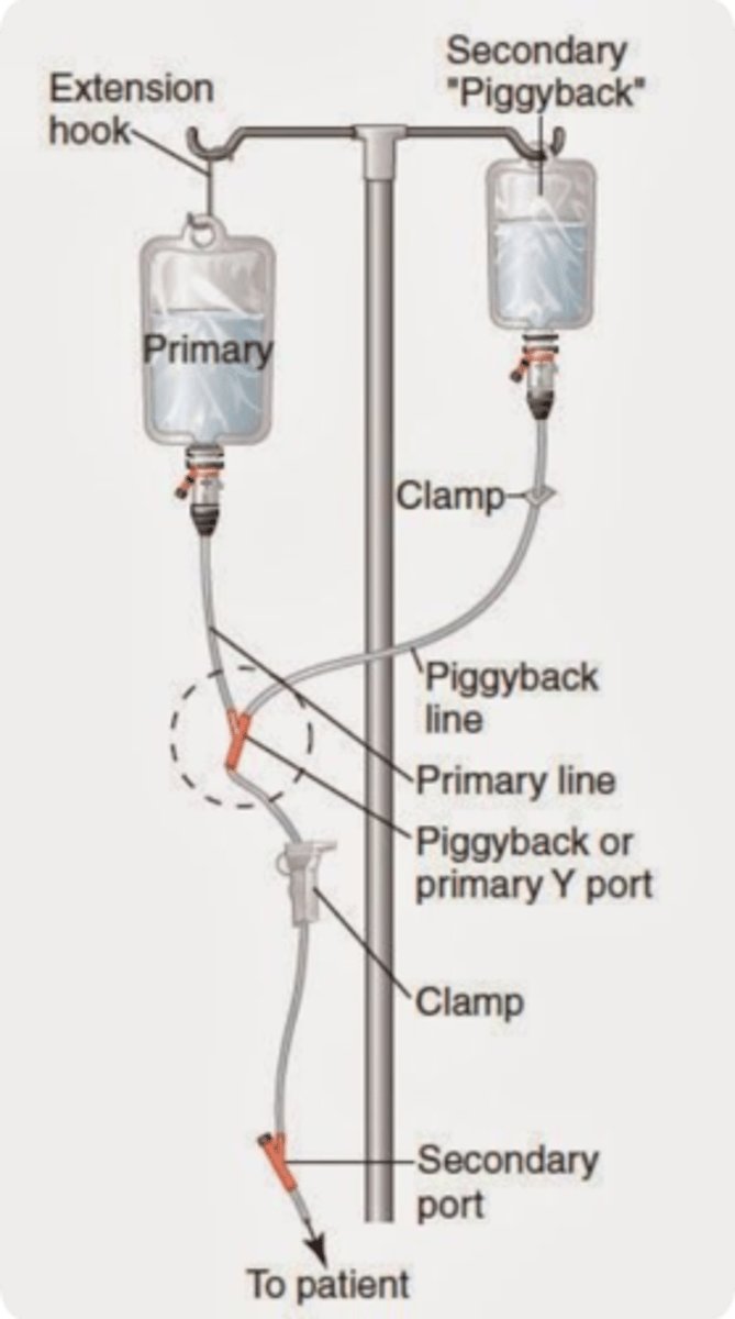<p>Piggy back set up</p>
