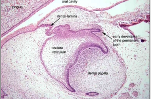 <p>What tissue does an odontogenic keratocyst arise from?</p>