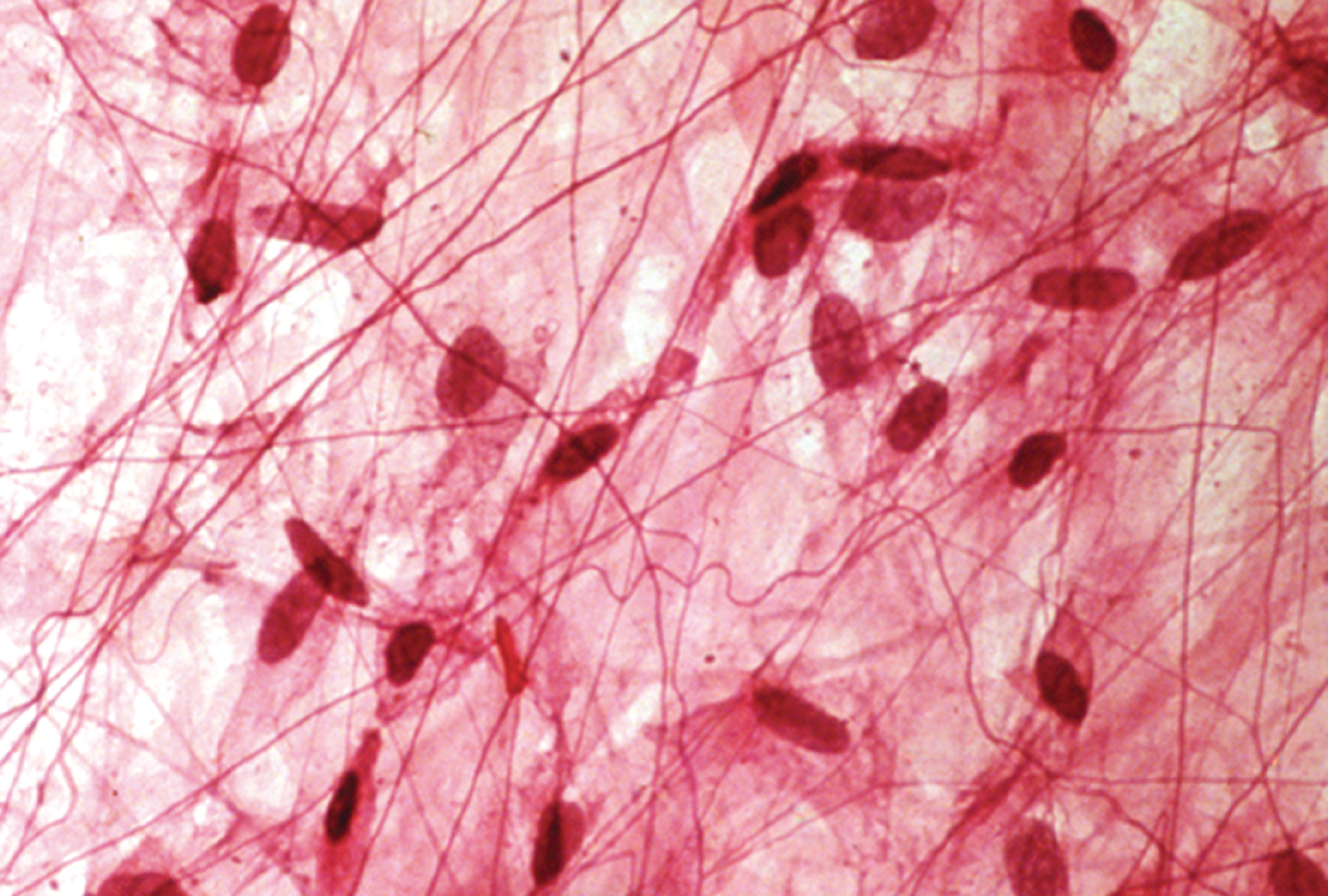 <p>A type of loose fibrous connective tissue that contains collagen fibers, elastic fibers, and reticular fibers; serves as passageways for blood vessels; underlies epithelia; found in serous membranes and in between muscles </p>