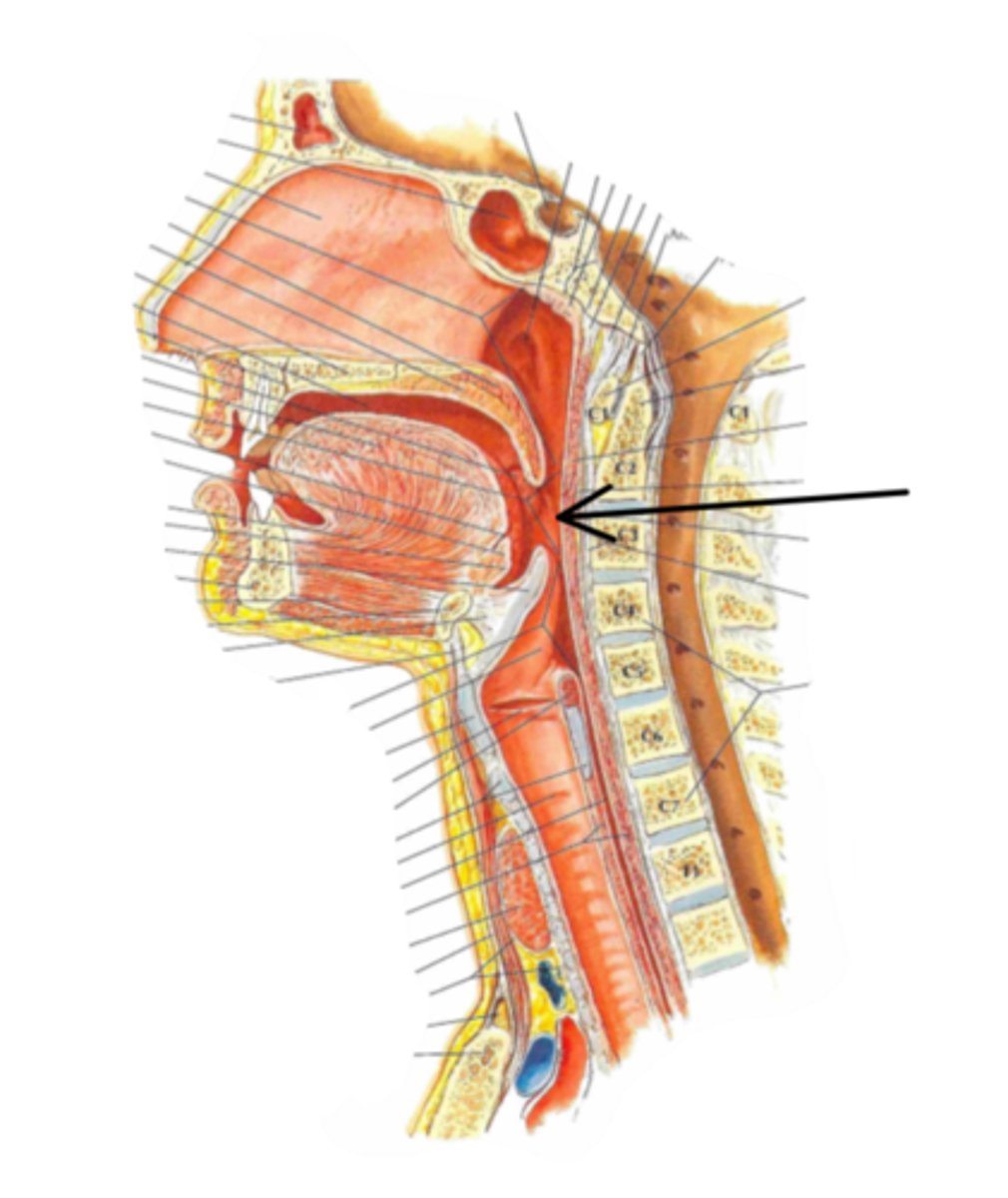 <p>Identify the structure indicated by the arrow</p>