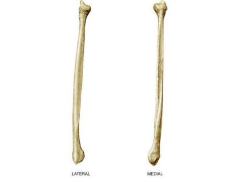 <p>What bone is this?</p>