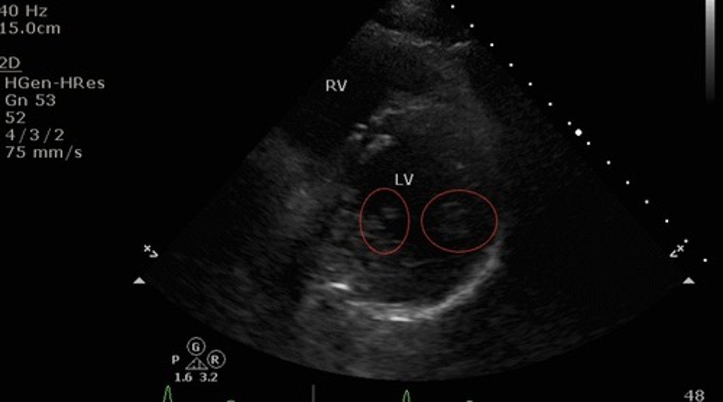 <p>What structures are indicated by the red circles?</p>
