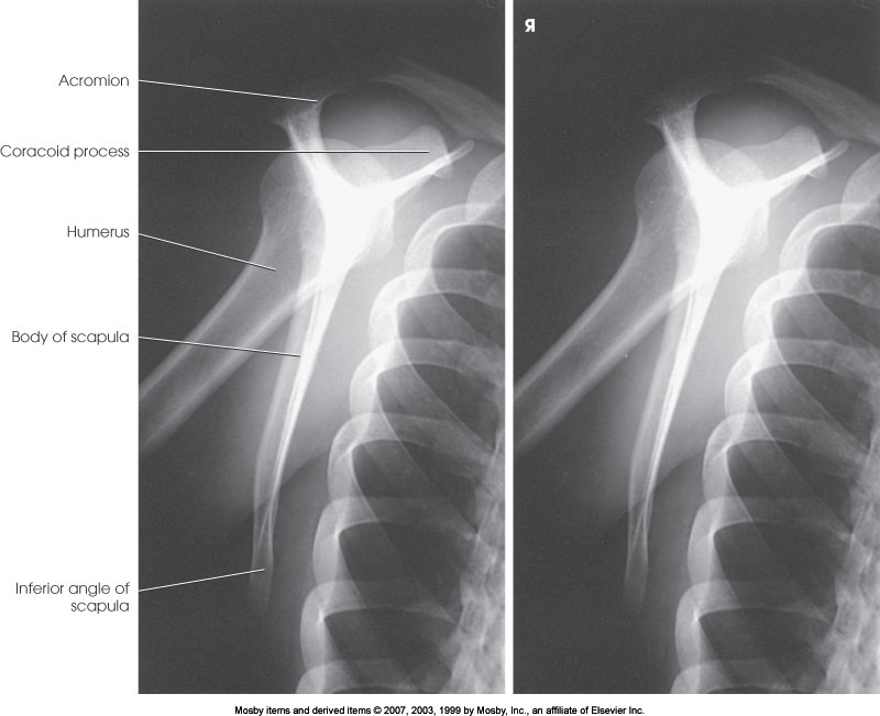 <p>What position is demonstrated?</p>