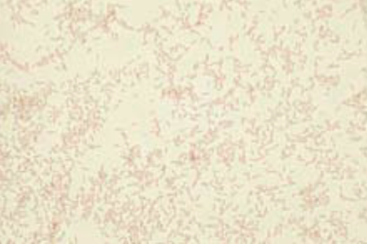 <ul><li><p>Facultative anaerobe</p></li><li><p>Small, straight, GNR</p></li><li><p>Small, grayish, with slight green discoloration on BAP</p></li><li><p><strong>Bleach-like odor</strong></p></li><li><p>Lemon-yellow pigment (observed on swab)</p></li><li><p>Approximately 50% pit or corrode agar</p></li><li><p><strong>Most commonly associated in wounds caused by human bites or “fistfights”</strong></p></li><li><p><strong>Also isolated from skin infections of drug addicts who lubricate needles with saliva before injecting drugs</strong></p></li></ul><p></p>