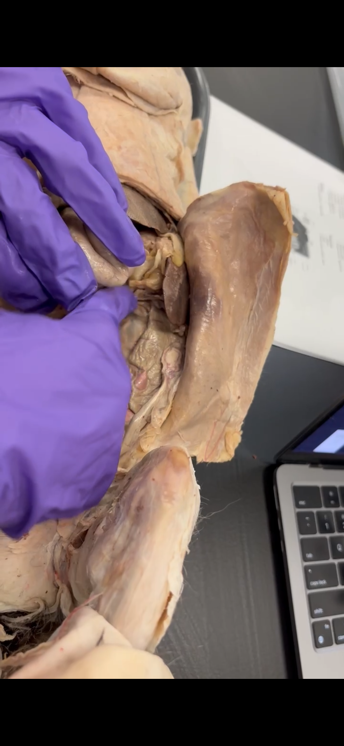 <p>What part of the colon is located here (goes across)</p>