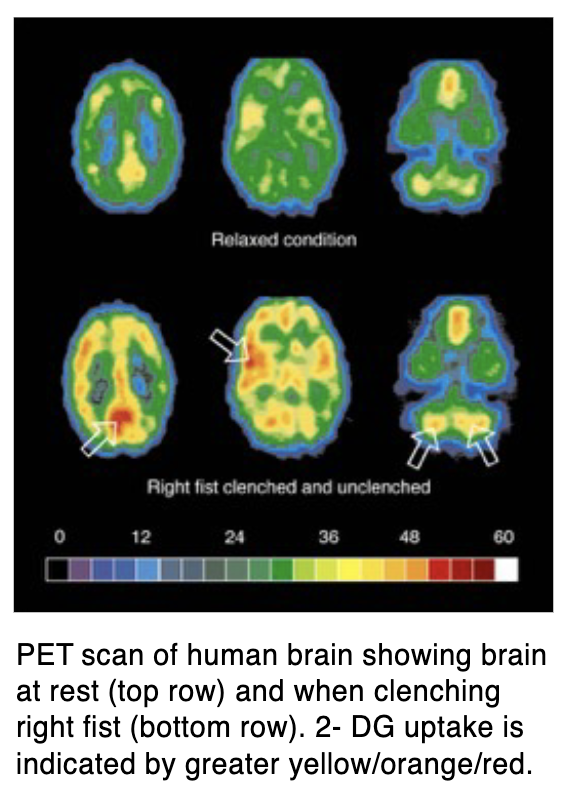 <p>PET → imaging technique that involves injections of radioactive compounds</p><ul><li><p>Radioactive sugar molecules are commonly used to detect changes in energy use</p><ul><li><p><strong>2-DG </strong>→ similar to glucose (consumed by active cells), however, it’s not metabolized as easily (endures)</p></li></ul></li><li><p>Scanning where and how radioactive sugar molecules move over time</p></li><li><p>PET substances can also measure changes in the expression levels of neurotransmitter receptors across weeks</p><p></p></li><li><p>Main disadvantages of PET scans are operating costs and safety precautions (radioactive molecules decay from the moment they’re produced, so they have to be made on-site and as close to the procedure as possible)</p></li><li><p>More recently superseded by fMRI</p></li></ul><p></p>