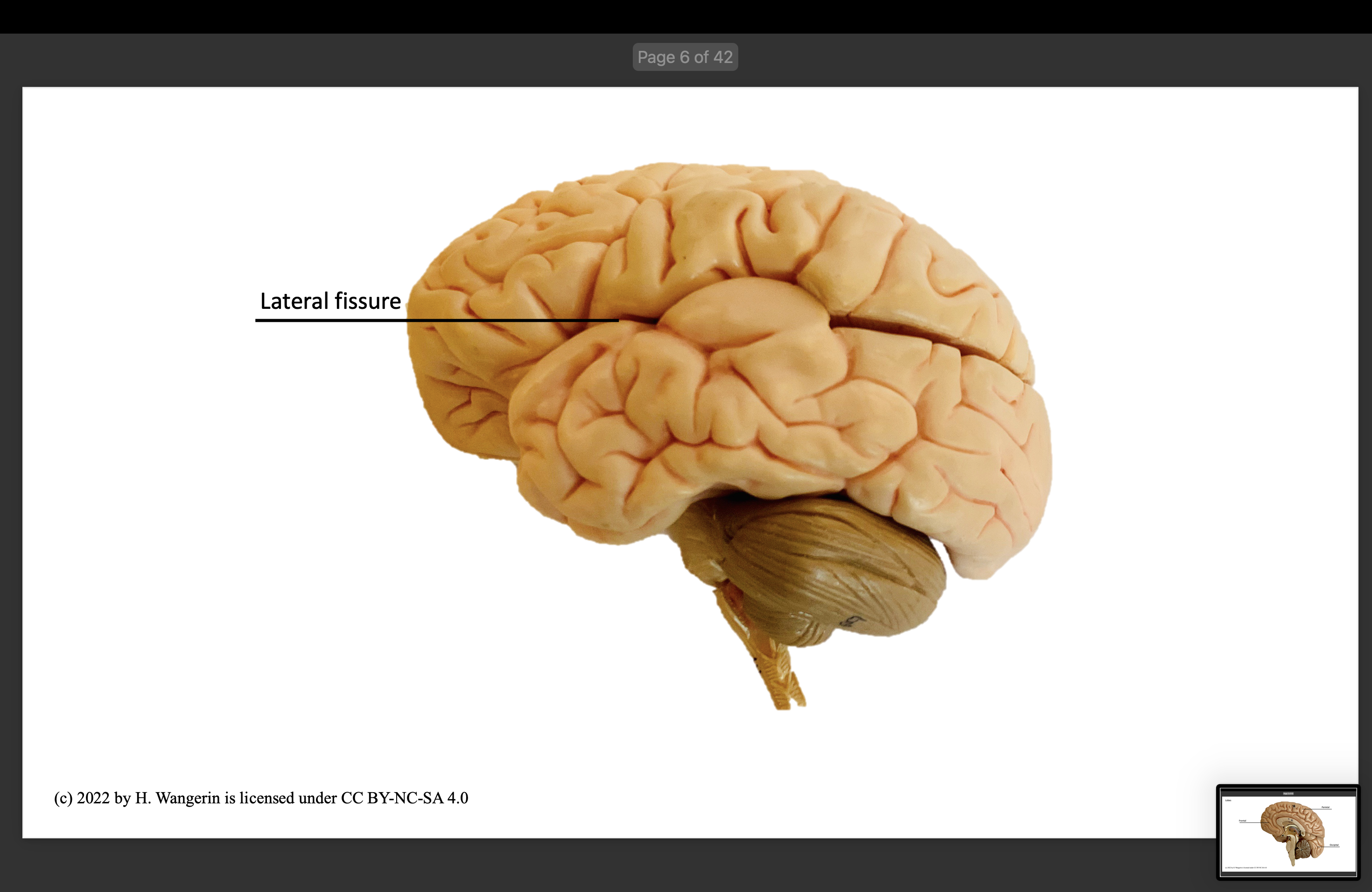 <p>Lateral fissure</p>