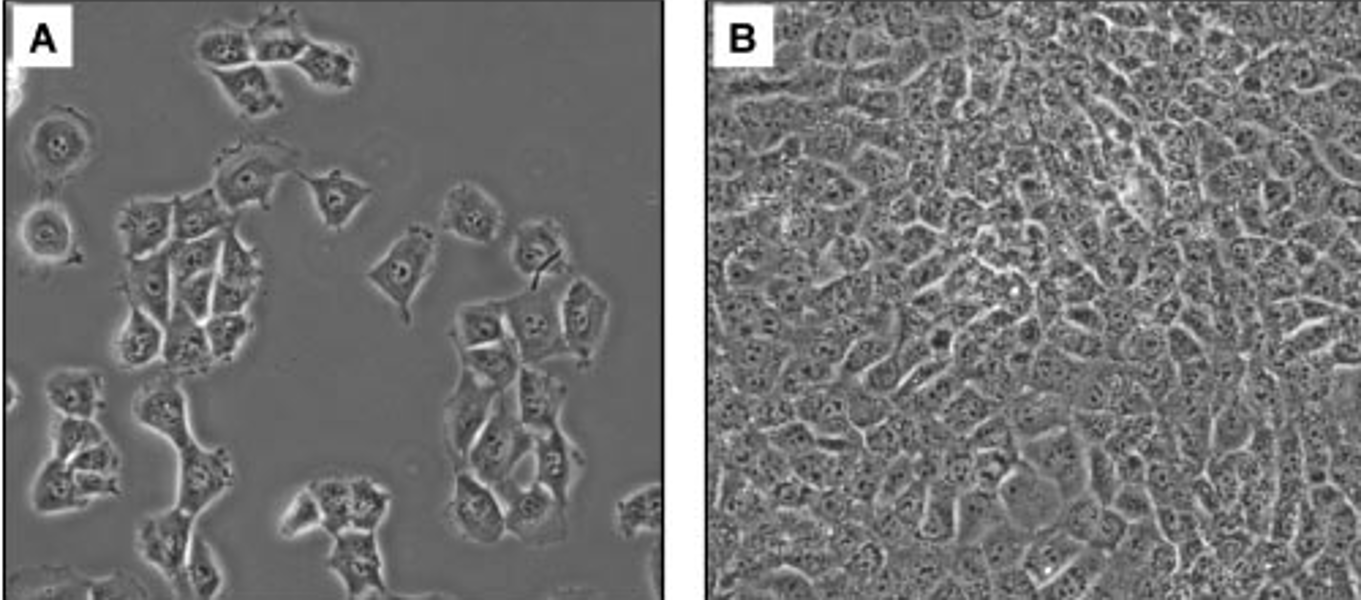 <ul><li><p> sparse culture - A</p></li><li><p>confluent cells - B </p></li></ul><p></p>