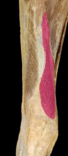 <p>on medial side of rectus femoris</p>