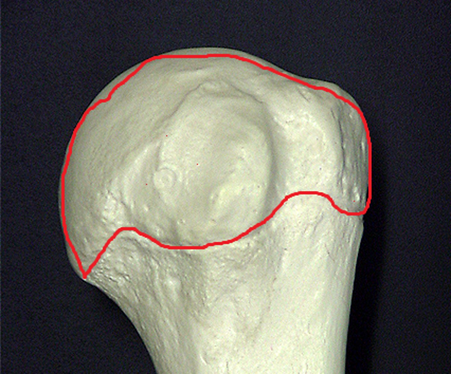 <p>the end of the bone located nearest to the midline of the body</p>