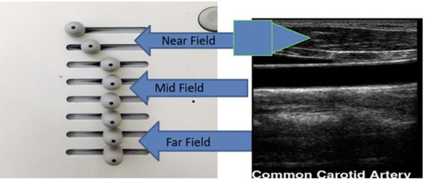 <p>Ability to compensate for attenuation of the transmittal beam as the sound wave travels through tissue in the body</p>