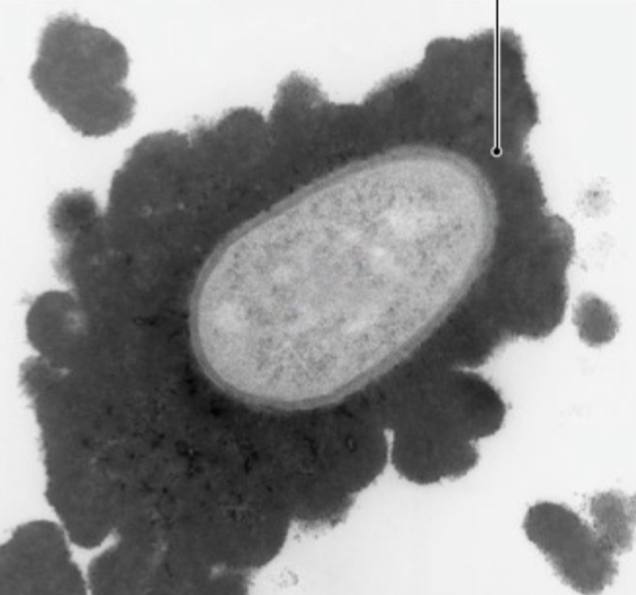 <p>A glycocalyx that is disorganized, without cell shape, and loosely attached to the cell wall.</p>
