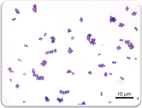 <p>What is the Gram reaction, arrangement, and morphology of the organisms shown in the image below?</p>