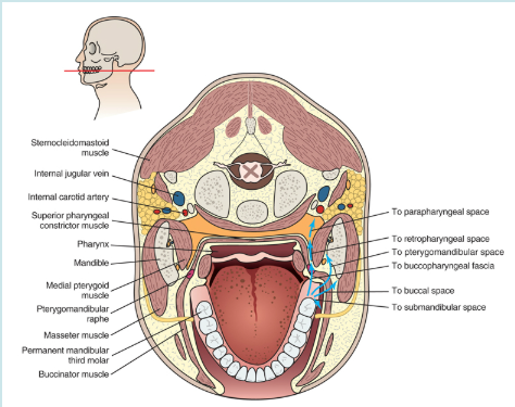 <p><span><span>AS INDICATED BY THE BLUE ARROWS, an infection of what tooth type can spread to many potential spaces?</span></span></p>