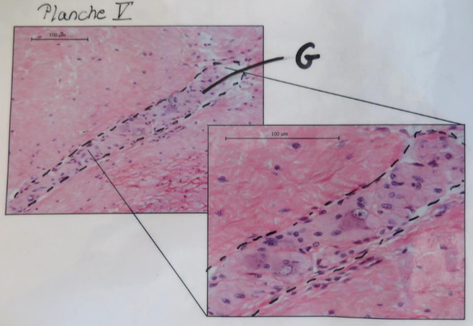 <p><strong>Post 5.</strong></p><p><u>Planche V er en detalje af præparatet på planche IV.</u></p><p></p><p><strong>Spørgsmål 10:</strong> Benævn nerven som innerverer strukturen markeret med G.</p>