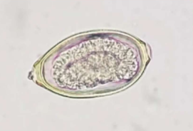 <p><span><span>Eucoleus böehmi</span></span></p>