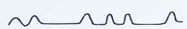 <p><strong>irregularly </strong>interspersed periods of <strong>apnea </strong>in a <strong>disorganized </strong>sequence of breaths</p>