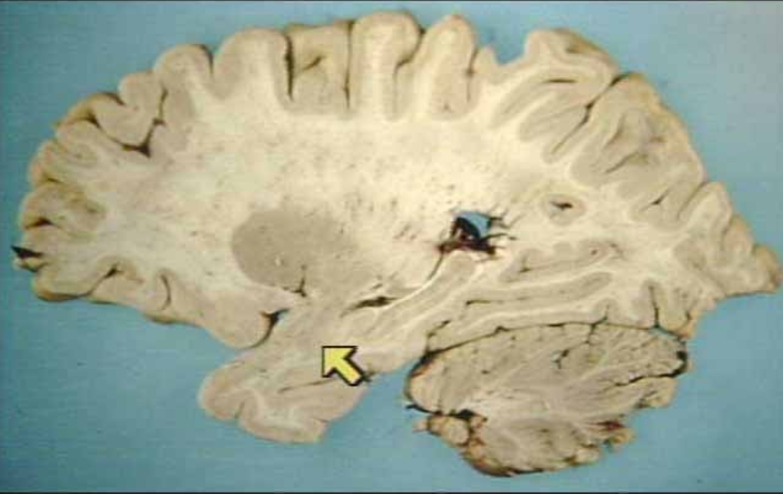 <p>What is the arrow pointing at?</p>