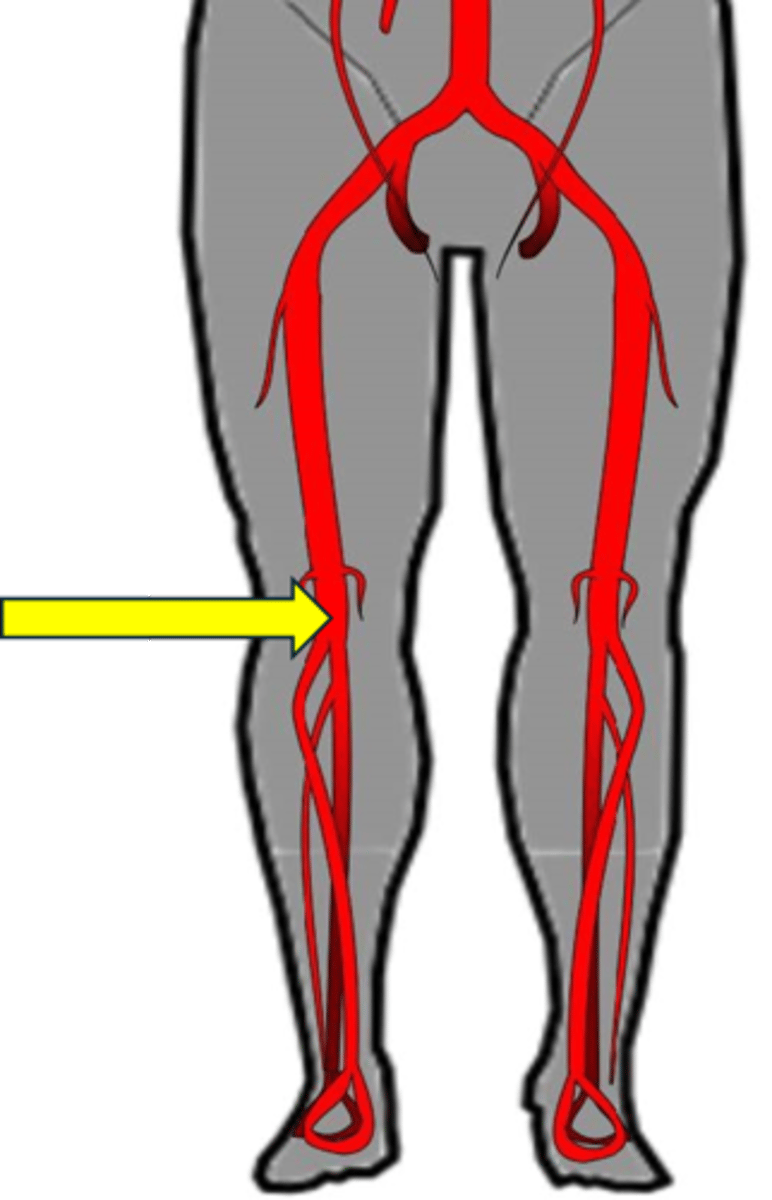 <p>Name the red vessel.</p>