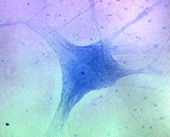 <p>Also known as neurons, of the nervous tissue are connected to other nerve cells as well. These neurons are supported by glial cells and create a fatty substance known as myelin that surrounds the neurons. Example: Brain</p>