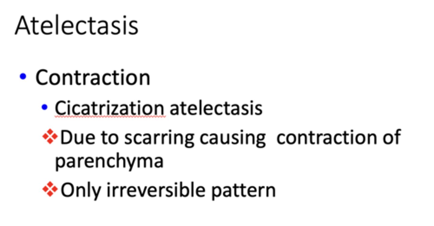 <p>Contraction</p>