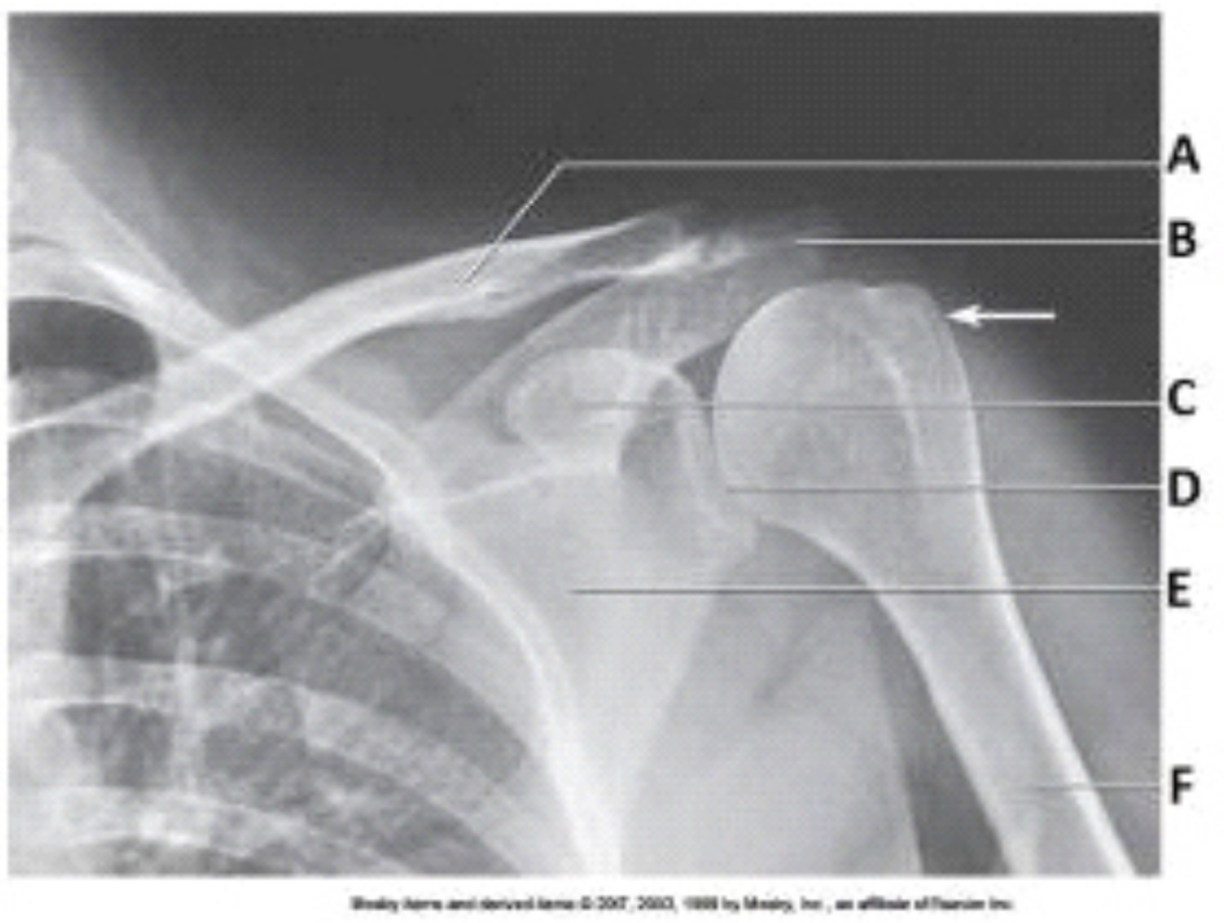 <p>The projection in the image below was obtained with the arm positioned in:</p>