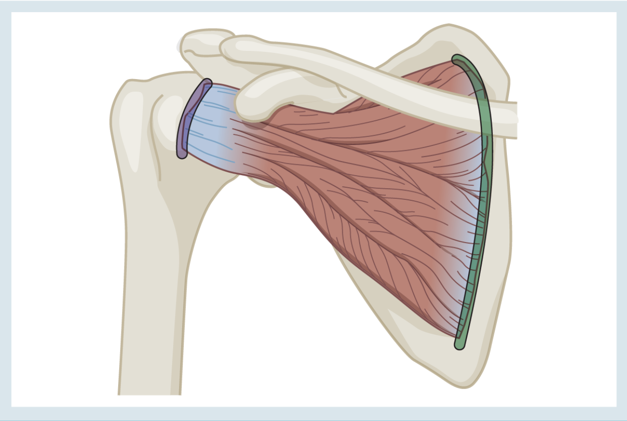 <p>Action : internal rotation </p><p>o : subscapular fossa </p><p>i : lesser tuberosity of humerus </p>