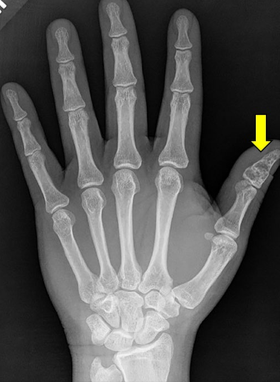term image