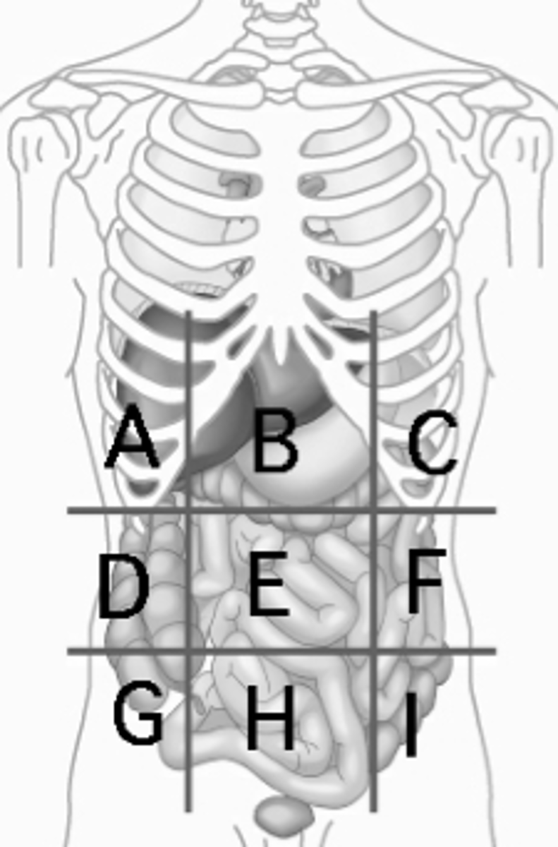 <p>What is the name of the abdominopelvic region indicated by the letter I?</p>