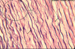 <p>BQ:What is this subcategory tissue type?*HINT- It is a connective tissue that provides strength and resistance to stretching.</p>