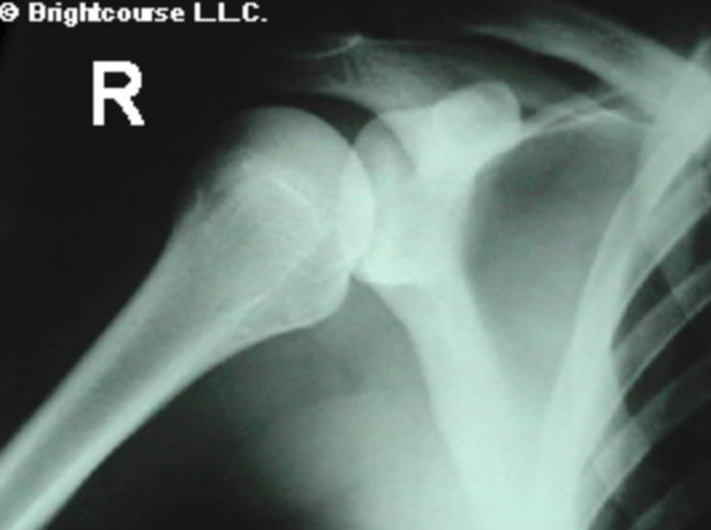 <p>What is the name of the radiographic projection?</p>