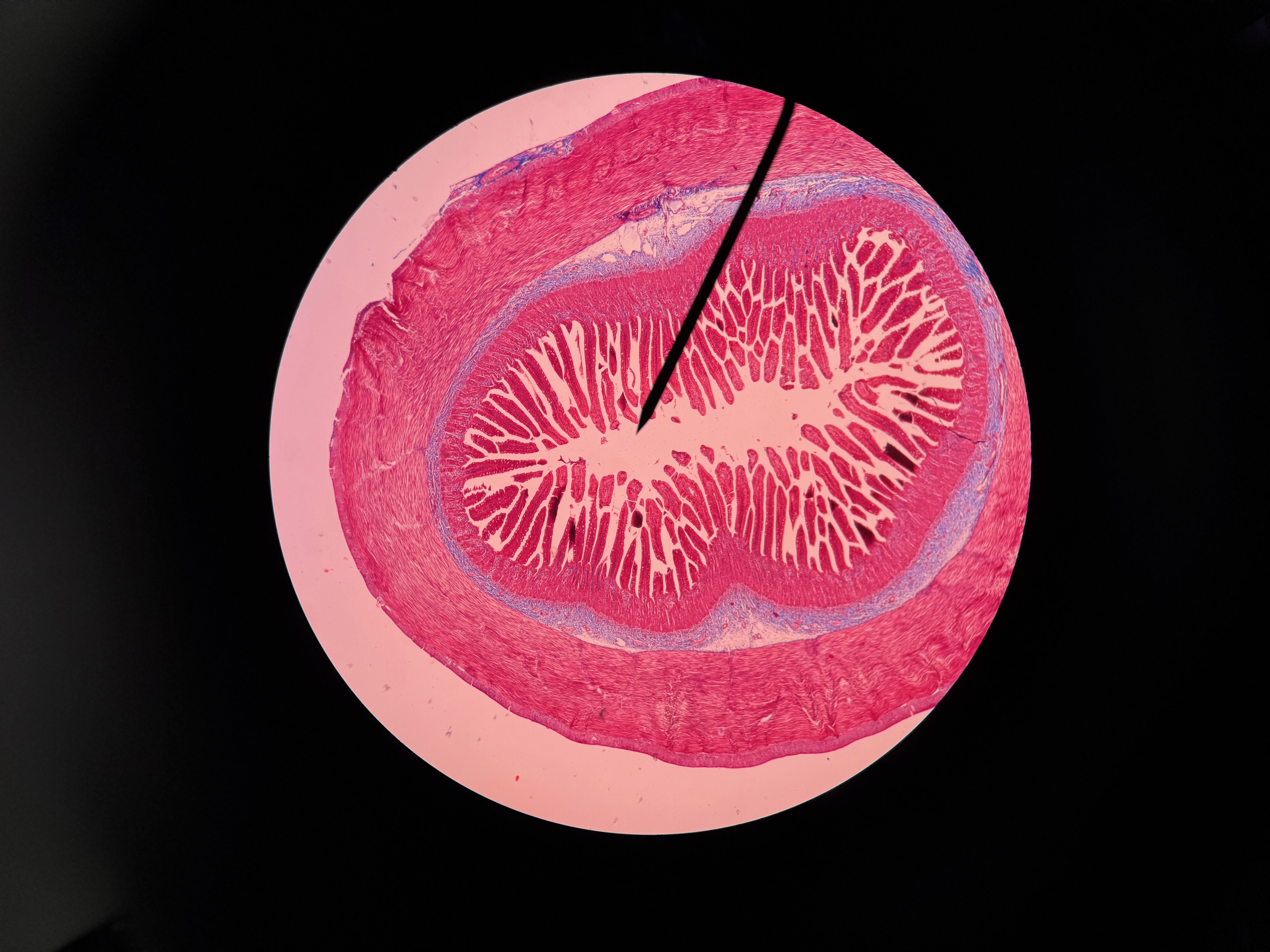 <p>Organ?</p><p>Region?</p>