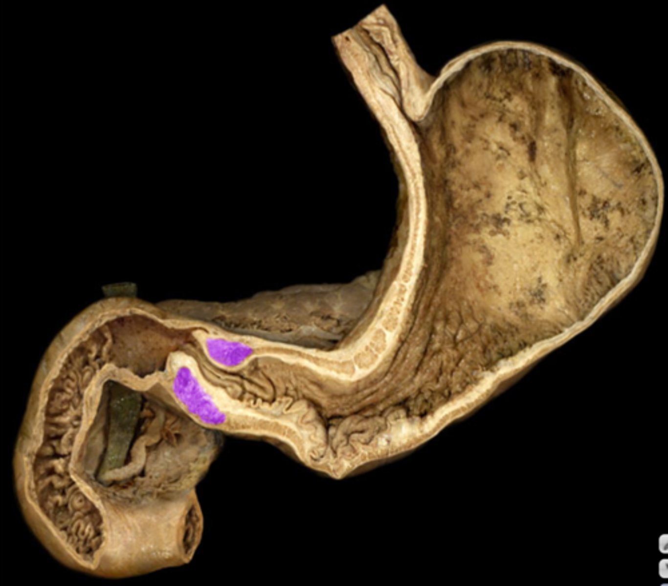 <p>Internal structure</p><p>- ridges</p><p>- TA will open the pylorus, and lay probe inside to show</p>