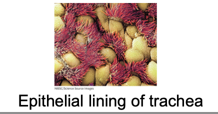 <p>smooth muscle and c-shaped rings of cartilage, lined w/ pseudo stratified ciliated columnar epithelium</p>
