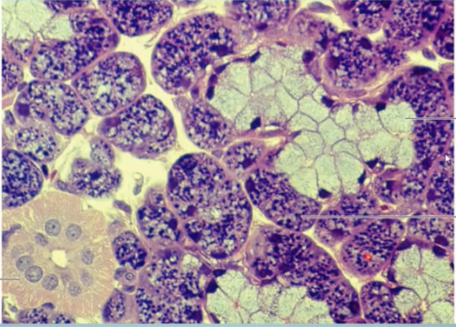 <p>what gland is this?</p>