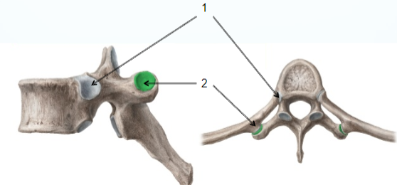 <p>name joint 1.</p>
