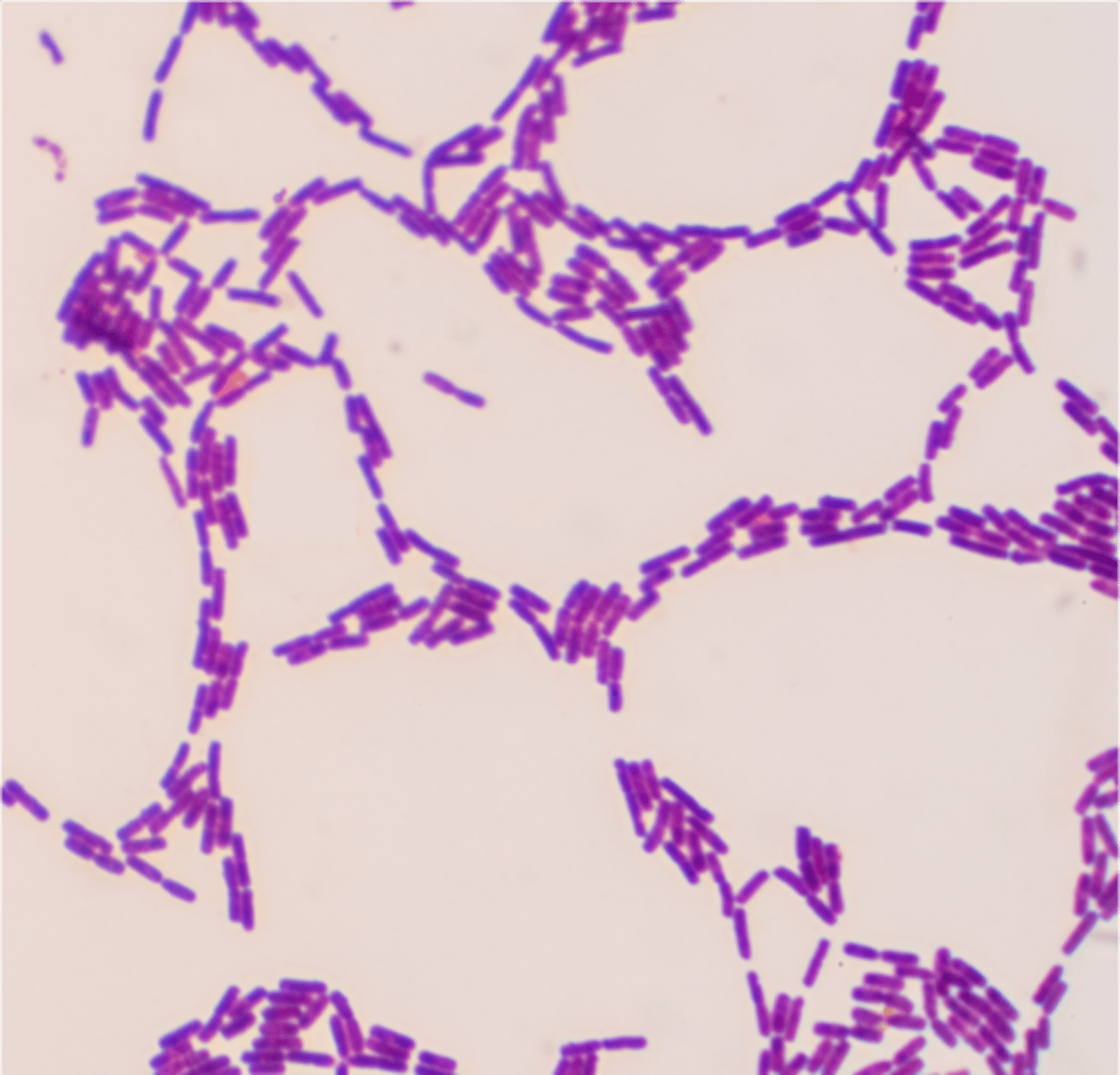 <p>What bacteria is this stained with crystal violet?</p>