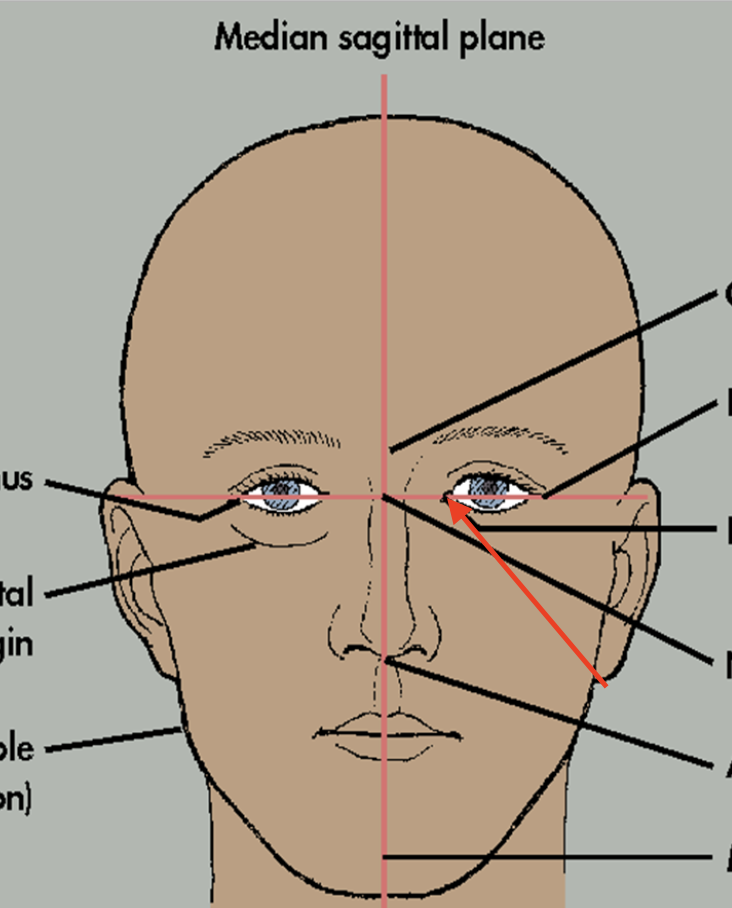 term image
