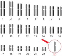 <p>(K3) Was ist das für eine Genommutation?</p>